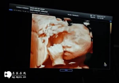 杭州代怀生男孩：﻿子宫内膜容受性检查——女性生育能力的关键